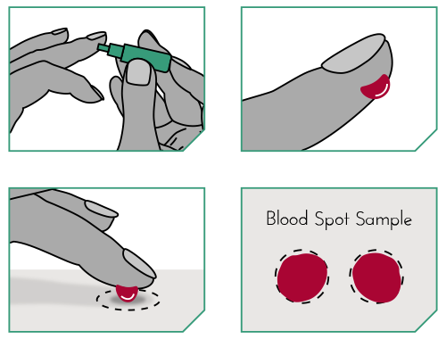 How blood spot samples are taken